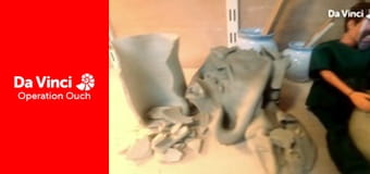 Operation Ouch! - Do Try This at Home - Urine