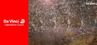 Operațiunea Au! - Clipeşte şi vei rata!