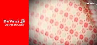 Operation Ouch! - Do Try This at Home - Osmosis