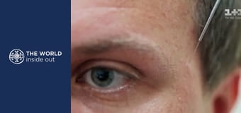 Aké je tajomstvo čínskeho zdravia? Čína.