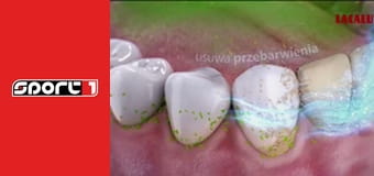 Labdarúgás. Bajnokok Ligája-magazin. - ism., HD