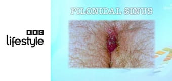 Wstydliwe choroby: wizyta kontrolna S5E3