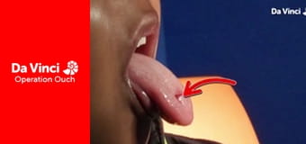 Operacja Auć! - Okołooczna obłędna okazja