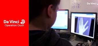 Operation Ouch! - Use Your Eardrum and Listen to the Radio