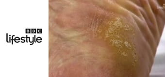 Wstydliwe choroby: wizyta kontrolna S2E2