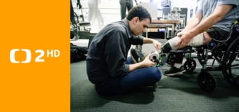 Robotické protézy - nová naděje