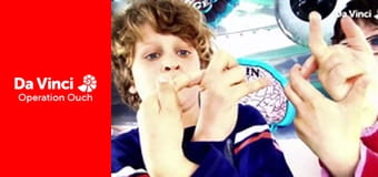 Operacja Auć! - Pierwsze niezwykłe narządy