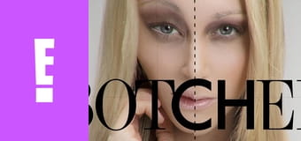 Botched S1E5 - The Chronicles Of Hernia