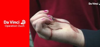 Операція «Ой!» - Історія чхання