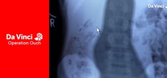 Operacja Auć! - Od choroby lokomocyjnej po dobrze przespane noce