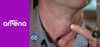 77 TV S3E5 - Przypadki medyczne