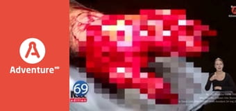 77 TV E15 - Przypadki w pracy