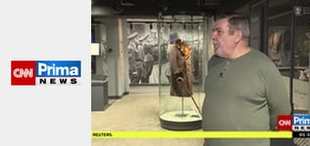 Co na to vaše zdraví - Péče o jizvy + Reflux