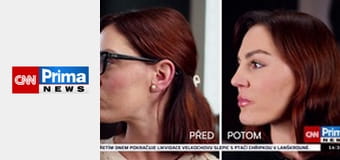 AI News - Finanční podvody