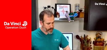 Operacja Auć: a właśnie, że róbcie to w domu! - Odciski palców