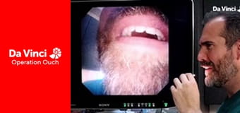 Operacja Auć: a właśnie, że róbcie to w domu! - Oczy