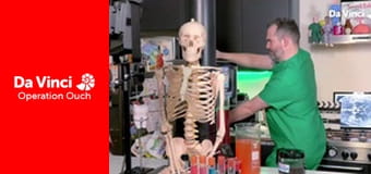 Operation Ouch! - Do Try This at Home - Reaction Times