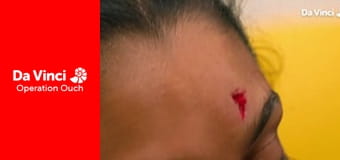 Operation Ouch! - Doctors Face Off!