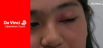 Operațiunea Au! - Energie explozivă!