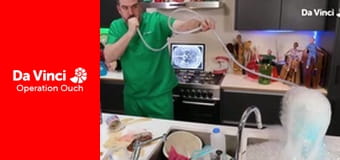 Operacja Auć: a właśnie, że róbcie to w domu! - Mocz