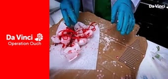 Operation Ouch! - Do Try This at Home - Invisible Ink