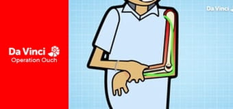 Operation Ouch! - The Journey from Mouth to Stomach Operation Ouch! - The Journey from Mouth to Stomach