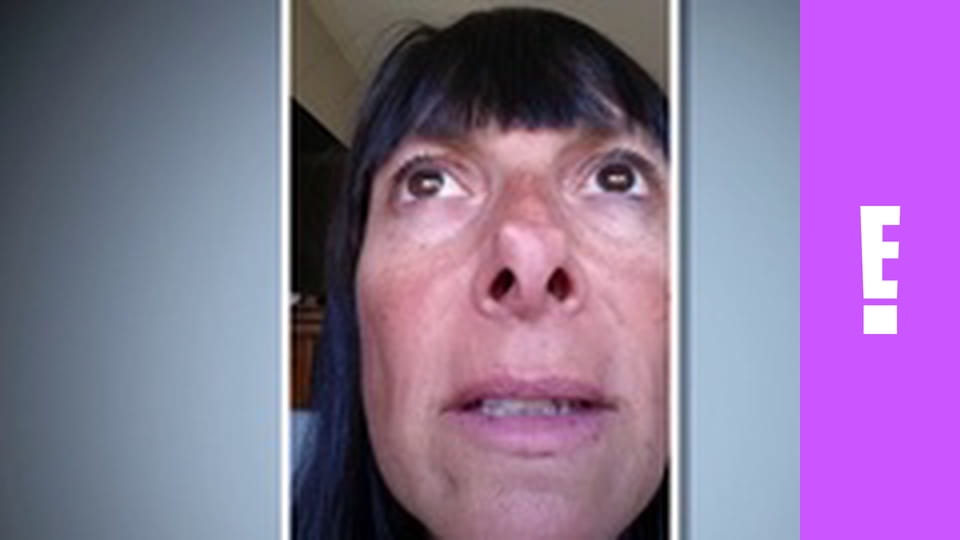 Botched S4E2 - Comic Proportions