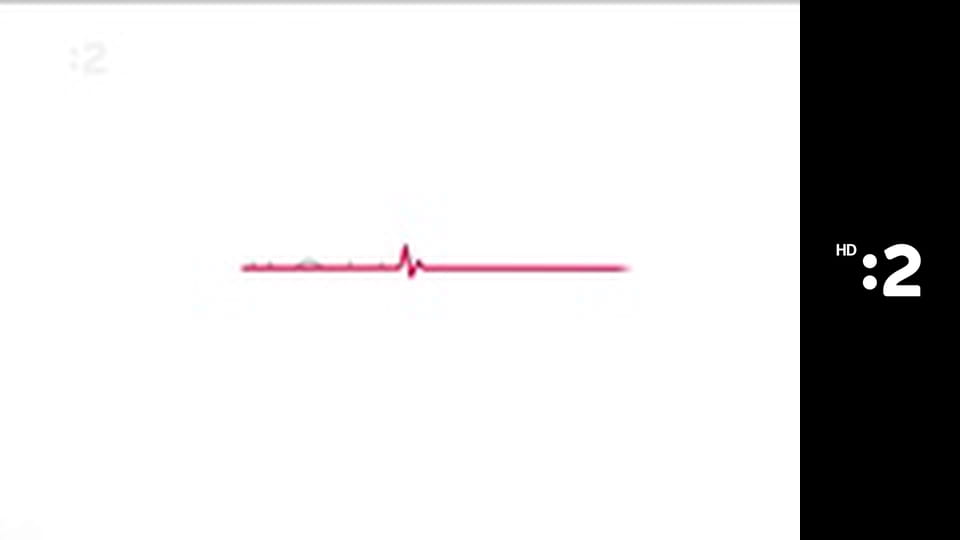 Moja diagnóza E12 - Zlovestná machuľa pred očami