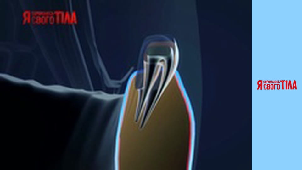 I'm Ashamed of My Body - Season 3 Episode 8 Part 4