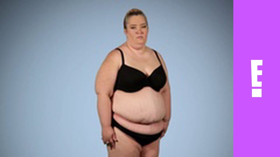 Botched S3E13 - Here Comes Tummy Boo Hoo