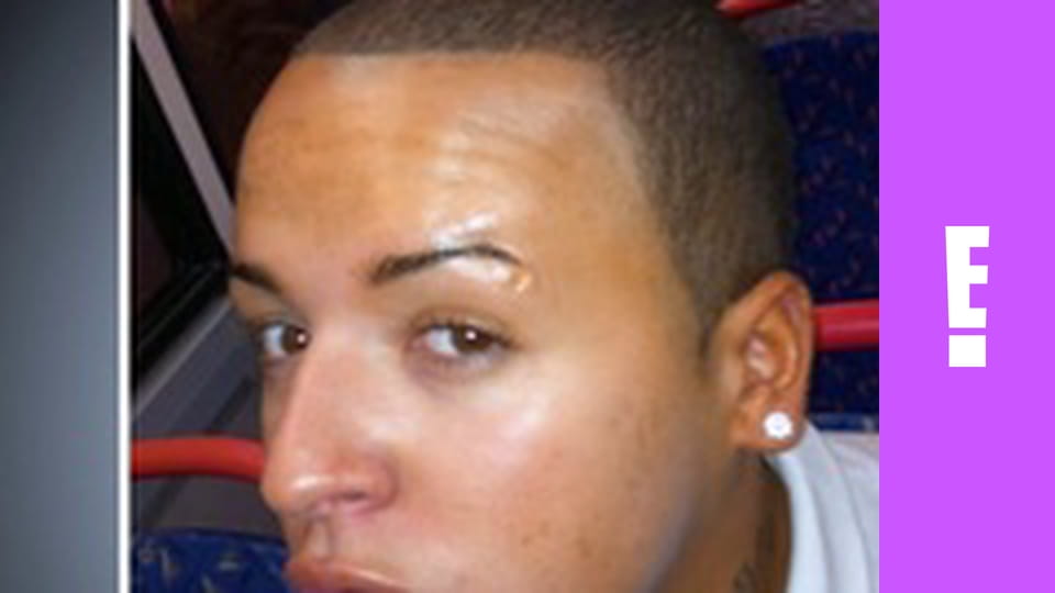 Botched S2E5 - Mo' Steroids Mo' Problems