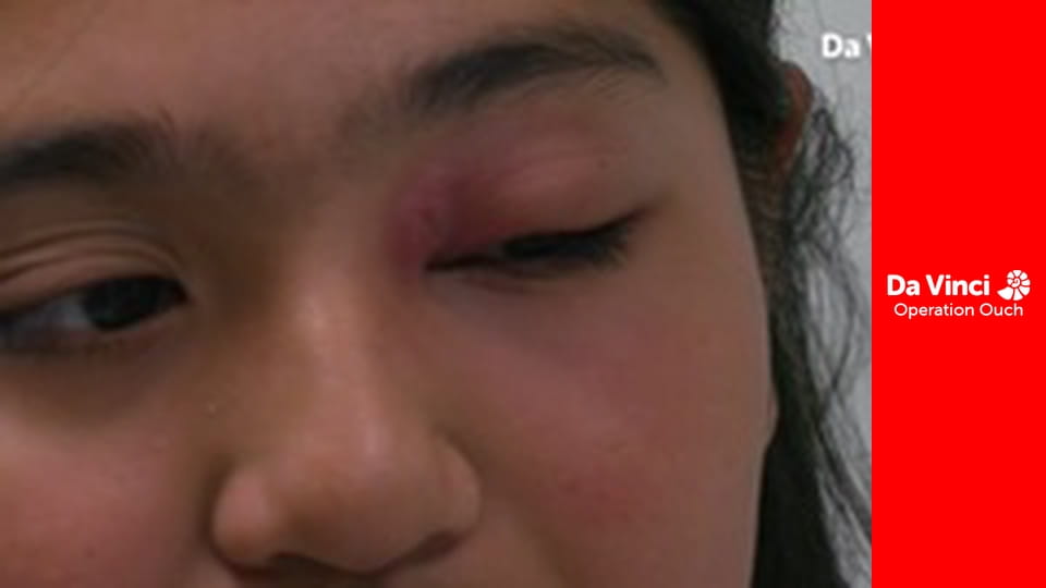 Operațiunea Au! - Energie explozivă!