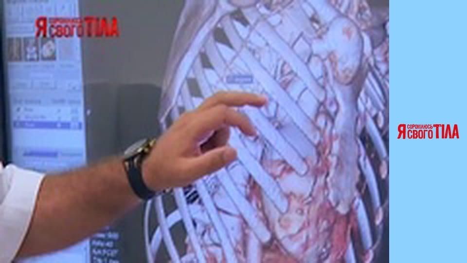 I'm Ashamed of My Body - Season 4 Episode 5 Part 1