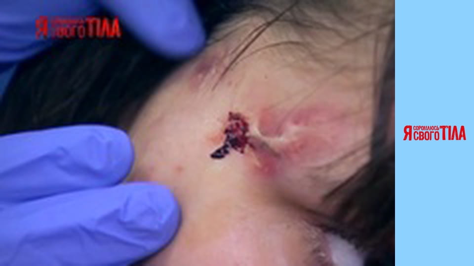 I'm Ashamed of My Body - Season 3 Episode 6 Part 2