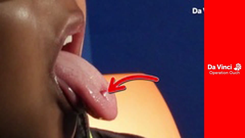 Ikerdokik bevetésen - Szembetűnő szemgolyók