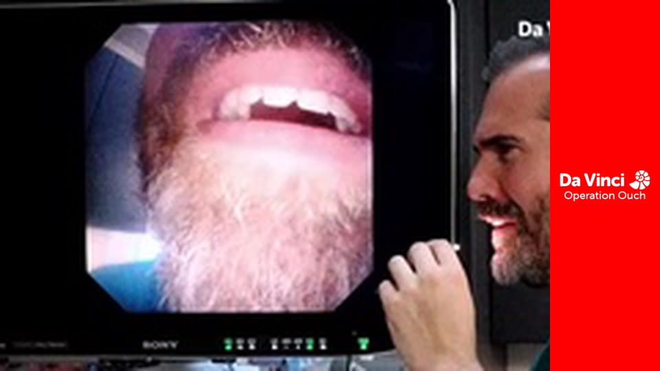 Operation Ouch! - Do Try This at Home - Eyes