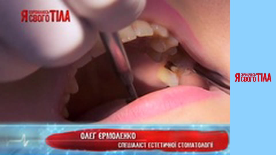 I'm Ashamed of My Body - Season 4 Episode 17 Part 4