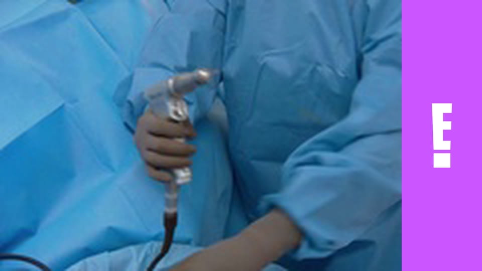 Botched S3E1 - Foreign Bodies