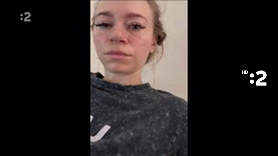 Moja diagnóza E13 - Endometrióza