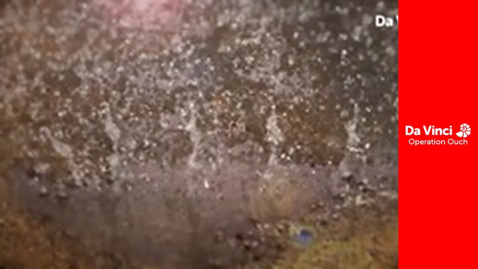 Operațiunea Au! - Clipeşte şi vei rata!