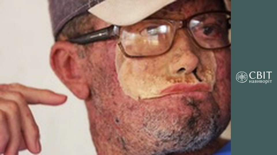 Сезон 10, Випуск 29, Бразилія