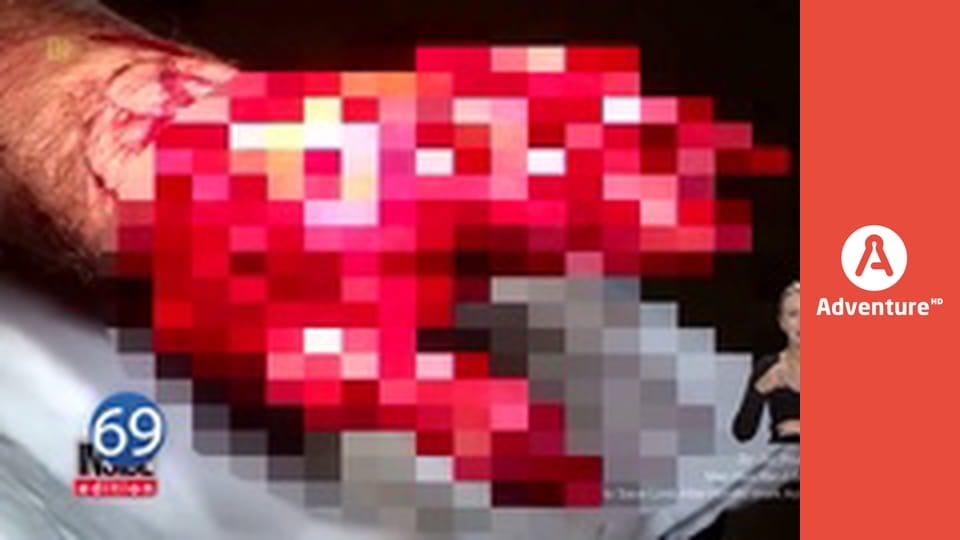 77 TV E15 - Przypadki w pracy