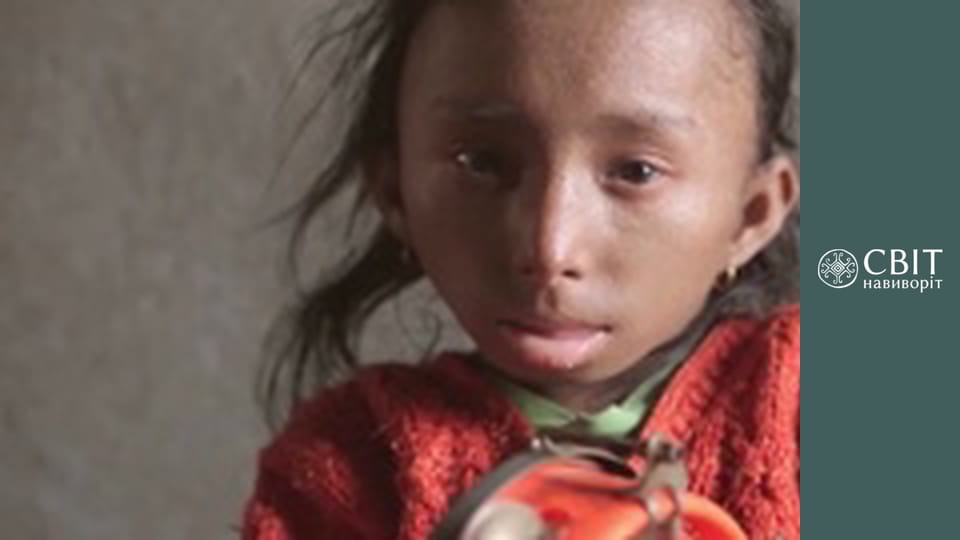 Season 8, Episode 4, Nepal