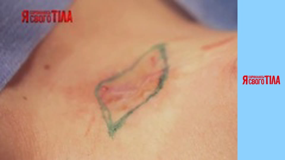 I'm Ashamed of My Body - Season 5 Episode 2 Part 9