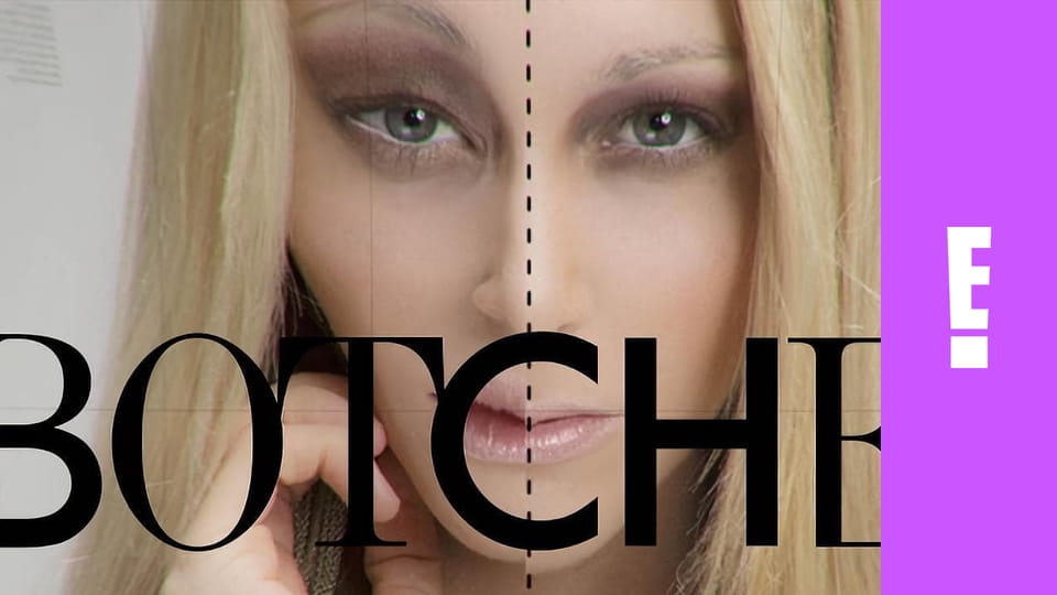 Botched S1E8 - Silicone Valley