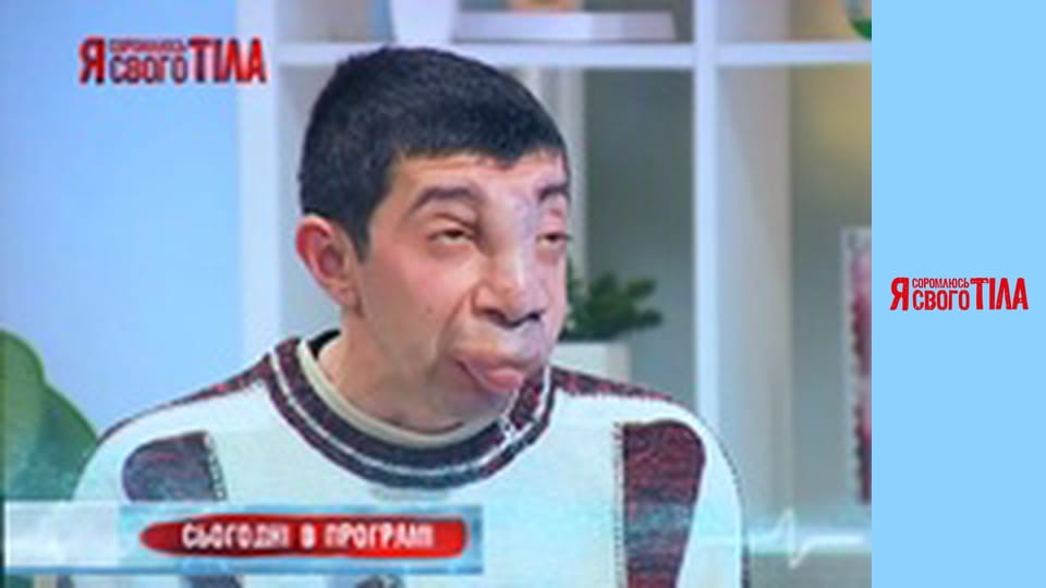 I'm Ashamed of My Body - Season 3 Episode 17 Part 1