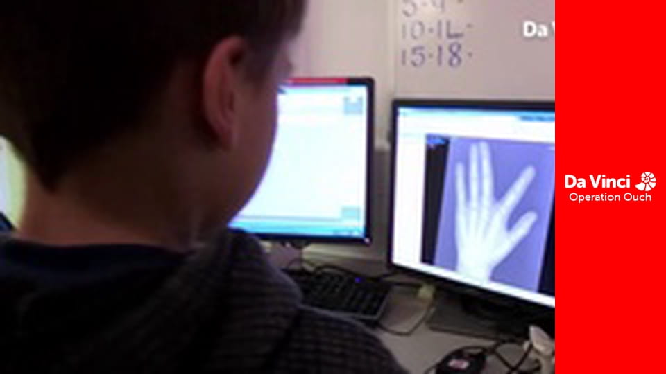 Operation Ouch! - Use Your Eardrum and Listen to the Radio