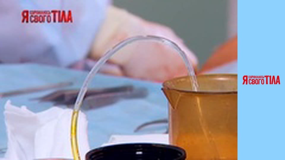 I'm Ashamed of My Body - Season 6 Episode 8 Part 7