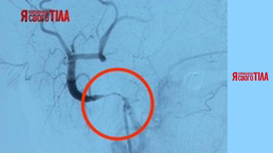 Я стыжусь своего тела - Сезон 5 Выпуск 5 Часть 9