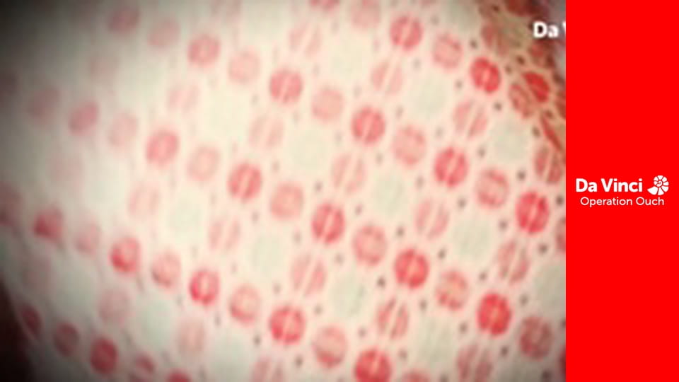 Operation Ouch! - Do Try This at Home - Osmosis